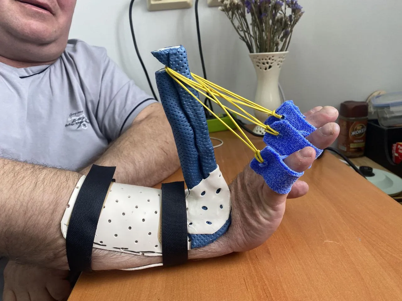 Пересадка сухожилий